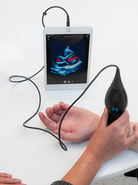 A portable ultrasound device examines a hand and displays the ultrasound on an iPad screen